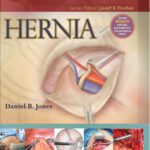 خرید و دانلود نسخه کامل کتاب Hernia