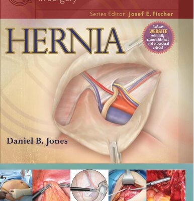 خرید و دانلود نسخه کامل کتاب Hernia
