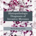 خرید و دانلود نسخه کامل کتاب Histopathologic Diagnosis of Invasive Mycoses