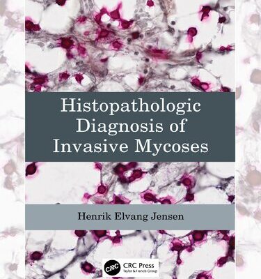 خرید و دانلود نسخه کامل کتاب Histopathologic Diagnosis of Invasive Mycoses