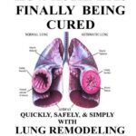 خرید و دانلود نسخه کامل کتاب HOW ASTHMA IS FINALLY BEING CURED-QUICKLY, SIMPLY, & SAFELY WITH HUMAN LUNG REMODELING HORMONE