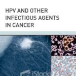 خرید و دانلود نسخه کامل کتاب HPV and Other Infectious Agents in Cancer: Opportunities for Prevention and Public Health