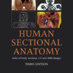 خرید و دانلود نسخه کامل کتاب Human Sectional Anatomy: Atlas of Body Sections, CT and MRI Images – 3rd edition