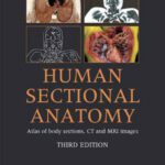 خرید و دانلود نسخه کامل کتاب Human Sectional Anatomy: Pocket Atlas of Body Sections, CT and MRI Images