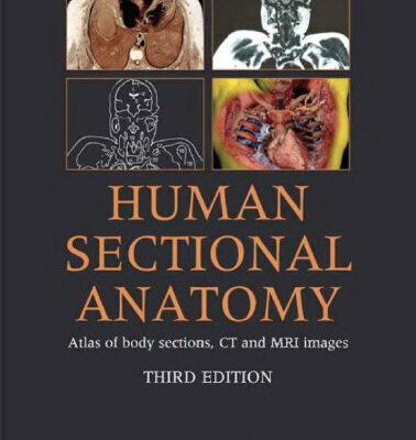 خرید و دانلود نسخه کامل کتاب Human Sectional Anatomy: Pocket Atlas of Body Sections, CT and MRI Images