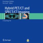 خرید و دانلود نسخه کامل کتاب Hybrid PET/CT and SPECT/CT Imaging: A Teaching File