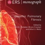 خرید و دانلود نسخه کامل کتاب Idiopathic Pulmonary Fibrosis