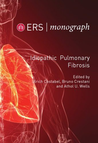 خرید و دانلود نسخه کامل کتاب Idiopathic Pulmonary Fibrosis_68b9f543e453d.jpeg خرید و دانلود نسخه کامل کتاب Idiopathic Pulmonary Fibrosis