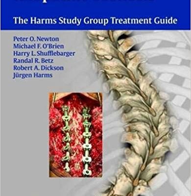 خرید و دانلود نسخه کامل کتاب Idiopathic Scoliosis: The Harms Study Group Treatment Guide – Original PDF