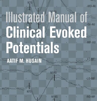 خرید و دانلود نسخه کامل کتاب Illustrated Manual of Clinical Evoked Potentials