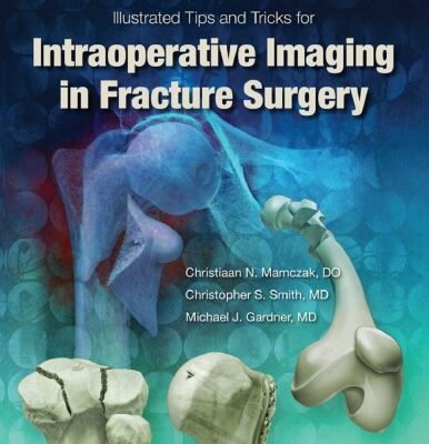خرید و دانلود نسخه کامل کتاب Illustrated Tips and Tricks for Intraoperative Imaging in Fracture Surgery