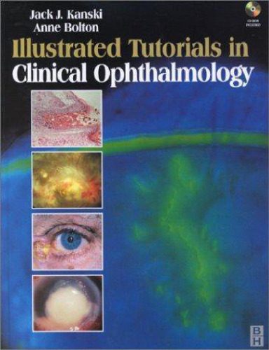 خرید و دانلود نسخه کامل کتاب Illustrated tutorials in clinical ophthalmology_68bbdb16b6bd2.jpeg خرید و دانلود نسخه کامل کتاب Illustrated tutorials in clinical ophthalmology