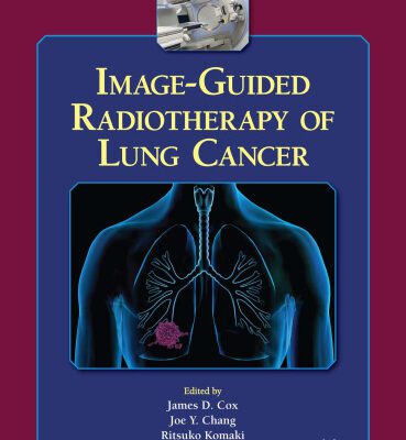 خرید و دانلود نسخه کامل کتاب Image-Guided Radiotherapy of Lung Cancer