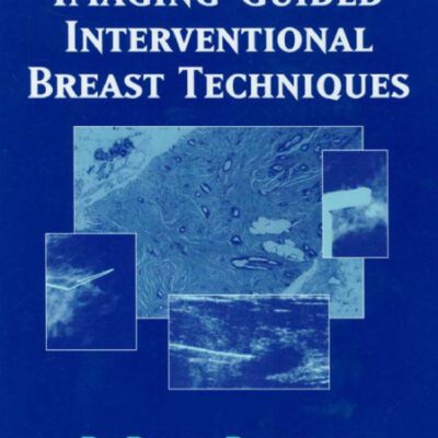 خرید و دانلود نسخه کامل کتاب Imaging-Guided Interventional Breast Techniques