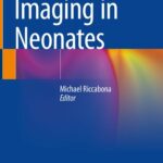 خرید و دانلود نسخه کامل کتاب Imaging in Neonates