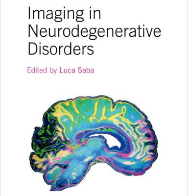 خرید و دانلود نسخه کامل کتاب Imaging in Neurodegenerative Disorders