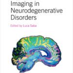 خرید و دانلود نسخه کامل کتاب Imaging in Neurodegenerative Disorders