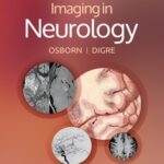 خرید و دانلود نسخه کامل کتاب Imaging in Neurology
