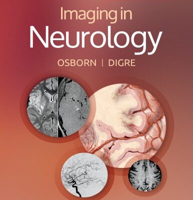 خرید و دانلود نسخه کامل کتاب Imaging in Neurology