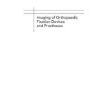 خرید و دانلود نسخه کامل کتاب Imaging of Orthopaedic Fixation Devices and Prostheses