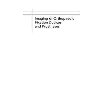 خرید و دانلود نسخه کامل کتاب Imaging of Orthopaedic Fixation Devices and Prostheses