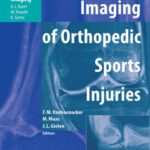 خرید و دانلود نسخه کامل کتاب Imaging of Orthopedic Sports Injuries