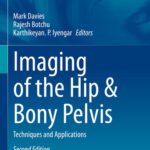 خرید و دانلود نسخه کامل کتاب Imaging of the Hip & Bony Pelvis: Techniques and Applications, Second Edition