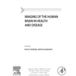 خرید و دانلود نسخه کامل کتاب Imaging of the Human Brain in Health and Disease