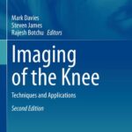 خرید و دانلود نسخه کامل کتاب Imaging of the Knee: Techniques and Applications