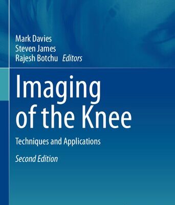 خرید و دانلود نسخه کامل کتاب Imaging of the Knee: Techniques and Applications