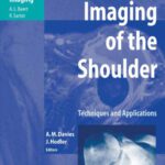 خرید و دانلود نسخه کامل کتاب Imaging of the Shoulder: Techniques and Applications (Medical Radiology   Diagnostic Imaging)