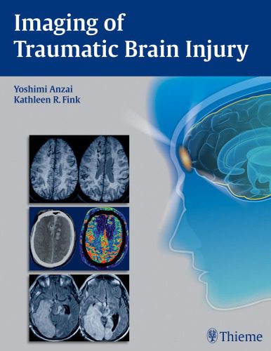 خرید و دانلود نسخه کامل کتاب Imaging of Traumatic Brain Injury_68bb533cc48b2.jpeg خرید و دانلود نسخه کامل کتاب Imaging of Traumatic Brain Injury