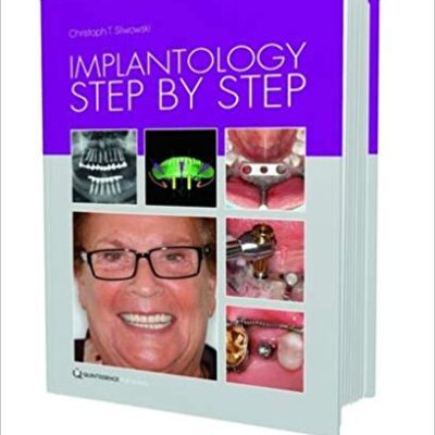 خرید و دانلود نسخه کامل کتاب Implantology Step by Step 2nd Edition