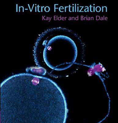 خرید و دانلود نسخه کامل کتاب In-Vitro Fertilization