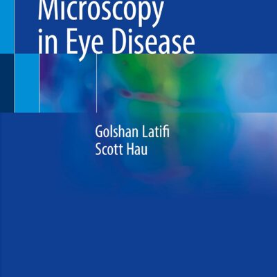 خرید و دانلود نسخه کامل کتاب In Vivo Confocal Microscopy in Eye Disease