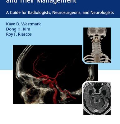 خرید و دانلود نسخه کامل کتاب Incidental Findings in Neuroimaging and Their Management: A Guide for Radiologists, Neurosurgeons, and Neurologists
