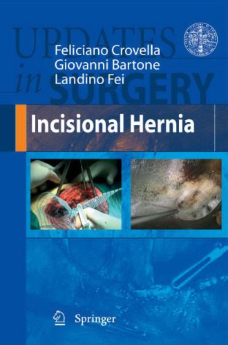 خرید و دانلود نسخه کامل کتاب Incisional Hernia (Updates in Surgery)_68bc5684701a3.jpeg خرید و دانلود نسخه کامل کتاب Incisional Hernia (Updates in Surgery)