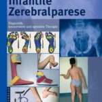 خرید و دانلود نسخه کامل کتاب Infantile Zerebralparese: Diagnostik, konservative und operative Therapie