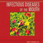خرید و دانلود نسخه کامل کتاب Infectious Diseases of the Mouth (Deadly Diseases and Epidemics)