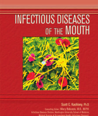 خرید و دانلود نسخه کامل کتاب Infectious Diseases of the Mouth (Deadly Diseases and Epidemics)