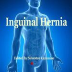 خرید و دانلود نسخه کامل کتاب Inguinal hernia