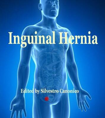 خرید و دانلود نسخه کامل کتاب Inguinal hernia