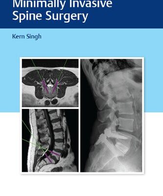 خرید و دانلود نسخه کامل کتاب Instrumentation for Minimally Invasive Spine Surgery