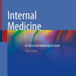 خرید و دانلود نسخه کامل کتاب Internal Medicine: An Illustrated Radiological Guide