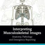خرید و دانلود نسخه کامل کتاب Interpreting Musculoskeletal Images: Anatomy, Pathology and Emergency Reporting