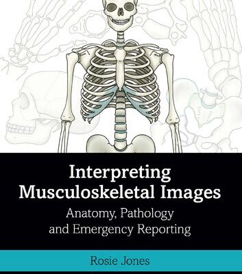 خرید و دانلود نسخه کامل کتاب Interpreting Musculoskeletal Images: Anatomy, Pathology and Emergency Reporting