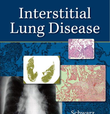 خرید و دانلود نسخه کامل کتاب Interstitial Lung Disease