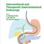 خرید و دانلود نسخه کامل کتاب Interventional and Therapeutic Gastrointestinal Endoscopy (Frontiers of Gastrointestinal Research)