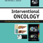 خرید و دانلود نسخه کامل کتاب Interventional Oncology: Principles and Practice of Image-Guided Cancer Therapy