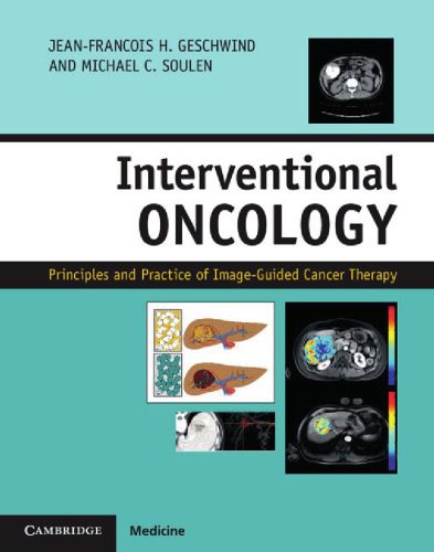 خرید و دانلود نسخه کامل کتاب Interventional Oncology: Principles and Practice of Image-Guided Cancer Therapy_68bb4e971eae7.jpeg خرید و دانلود نسخه کامل کتاب Interventional Oncology: Principles and Practice of Image-Guided Cancer Therapy